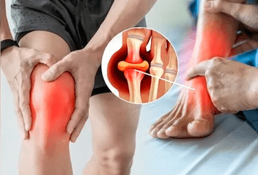 Shema nanošenja Icexin gela na područje zgloba koljena i stopala